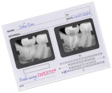 xray card 1 diagonal