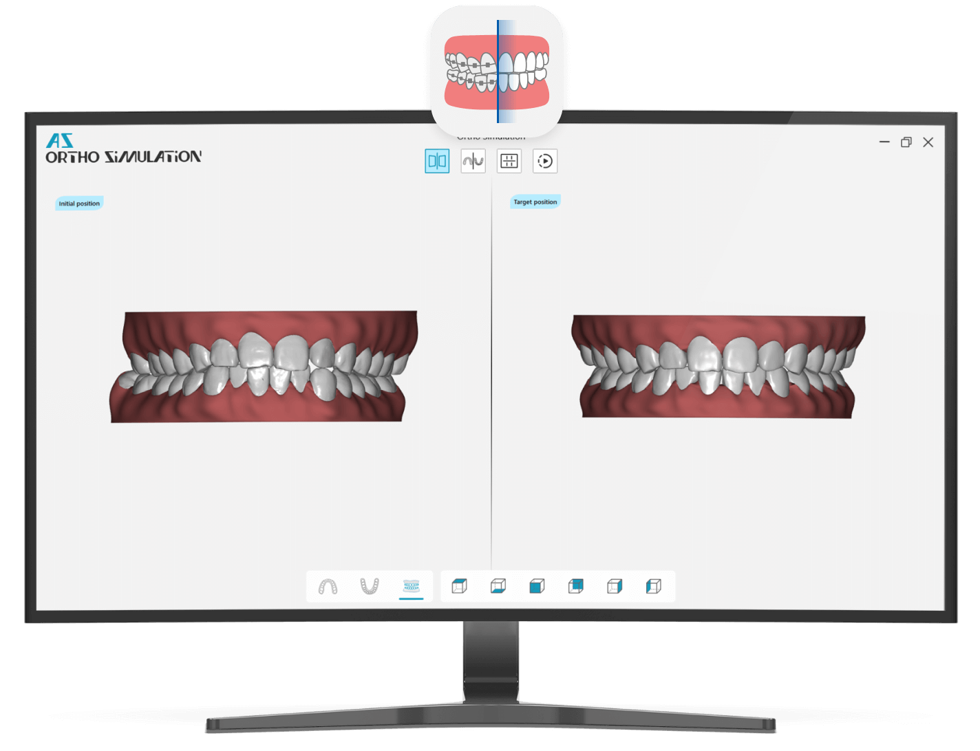 ortho_simulation